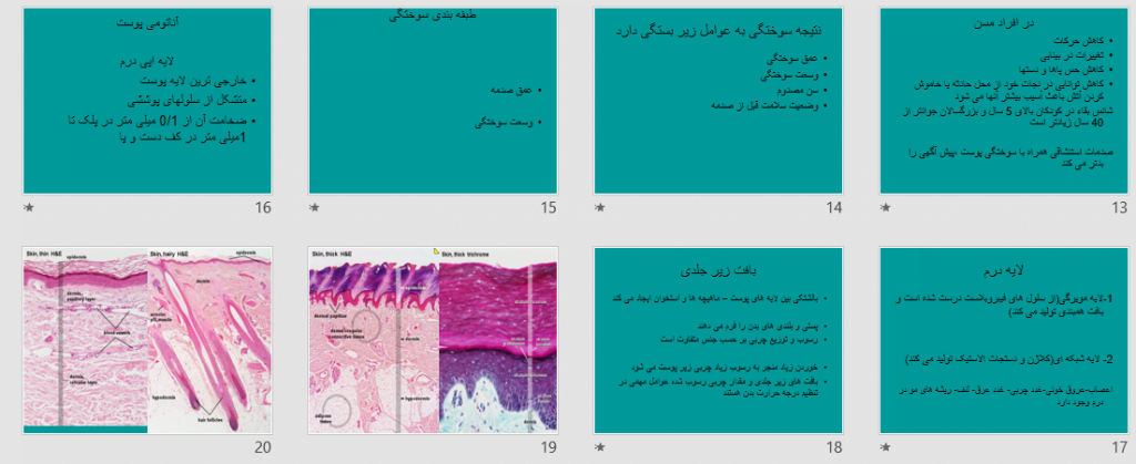 پاورپوینت سوختگی