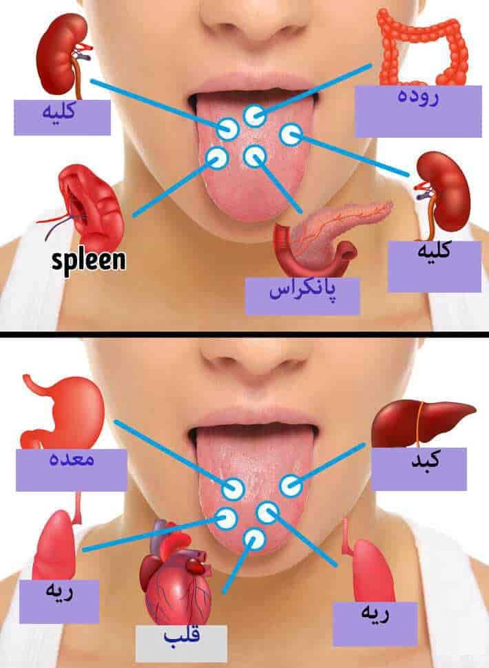 روش تشخیص بیماری از روی زبان