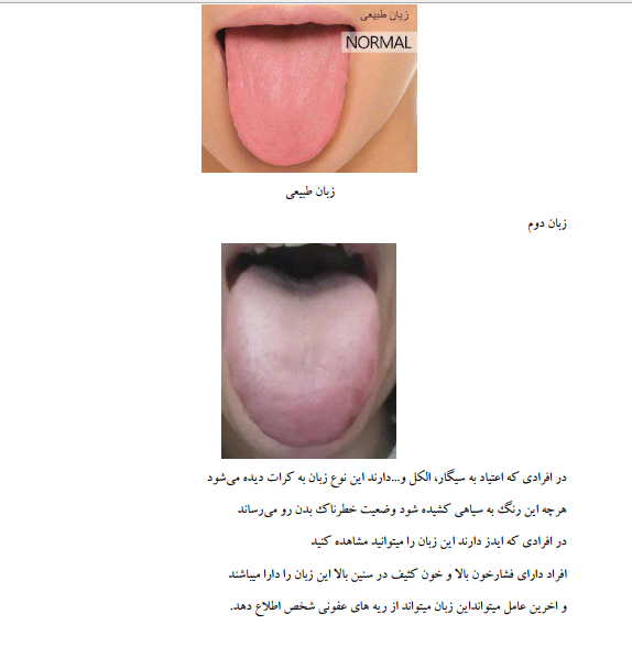 تشخیص بیماری از روی زبان در طب سنتی pdf